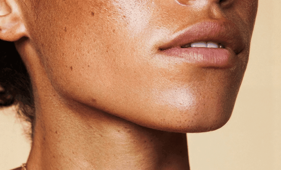 woman showing the lip results