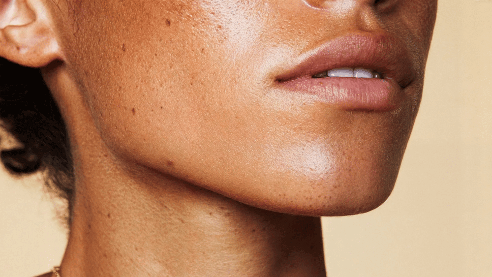 Lip Fillers vs Cheek Fillers: Why Longevity Is Different